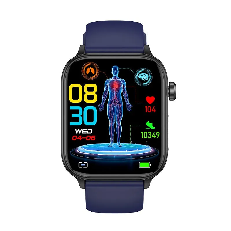 ECG AI medical diagnosis   Bluetooth call  with SOS emergency call  smart watch