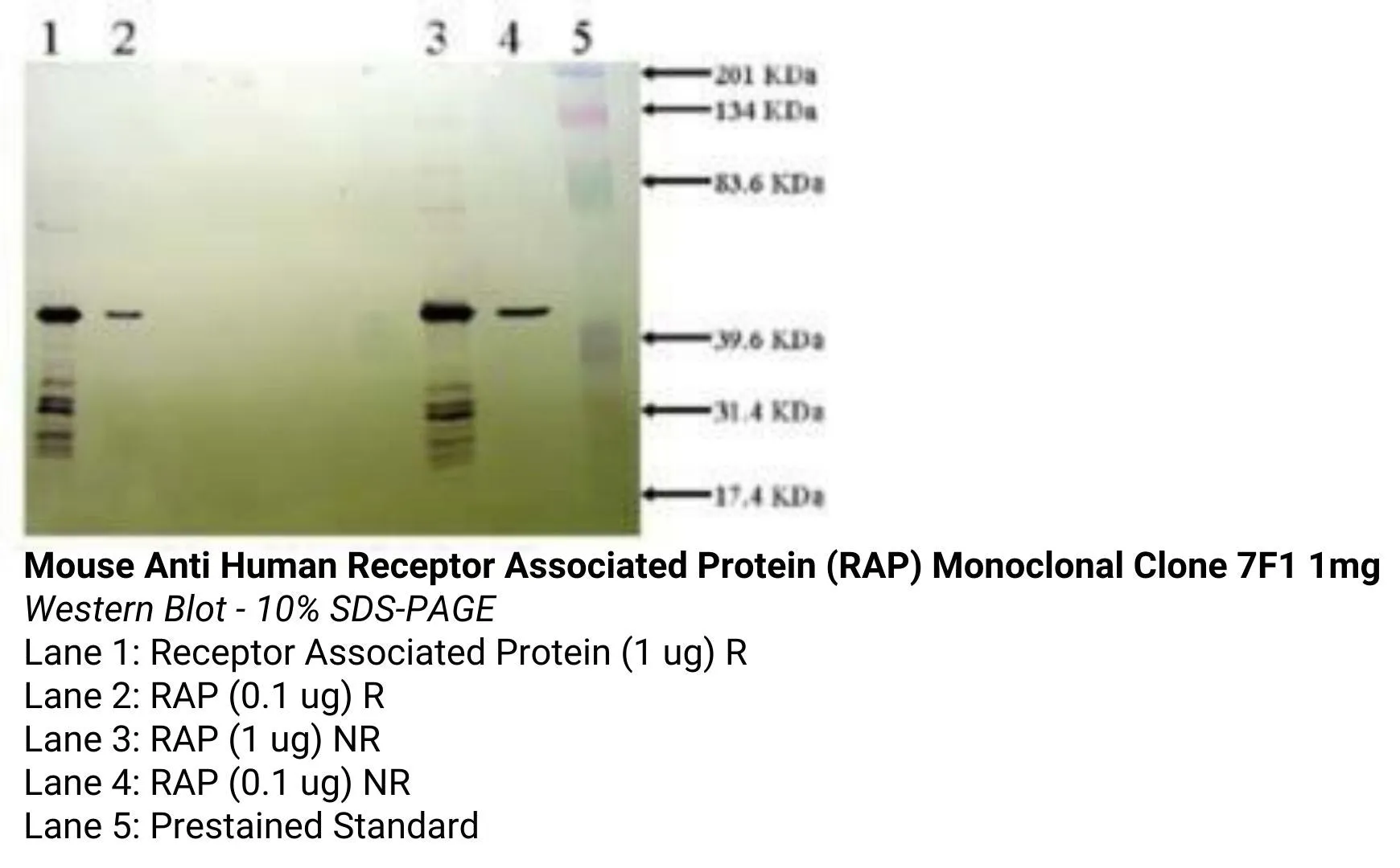 *Mouse Anti Human Receptor Associated Protein (RAP) Monoclonal Clone 7F1