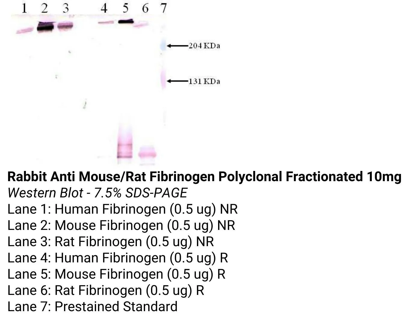 *Rabbit Anti Mouse/Rat Fibrinogen Polyclonal Fractionated