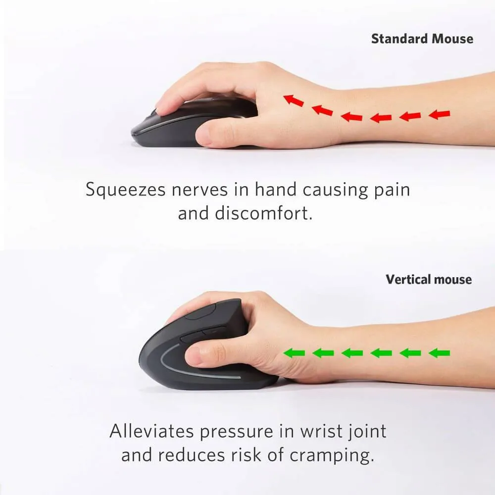 Wireless Right-Handed Vertical Ergonomic Mouse